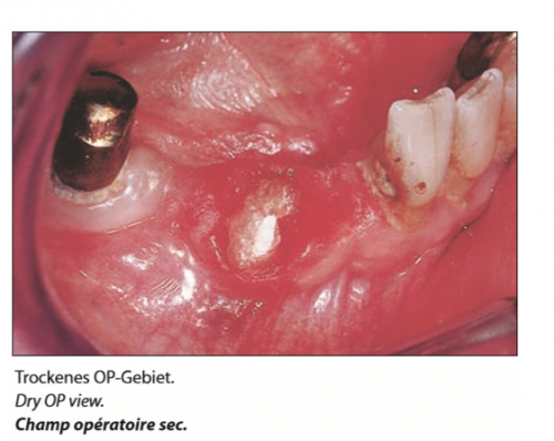 Trimmer Tissue (2)