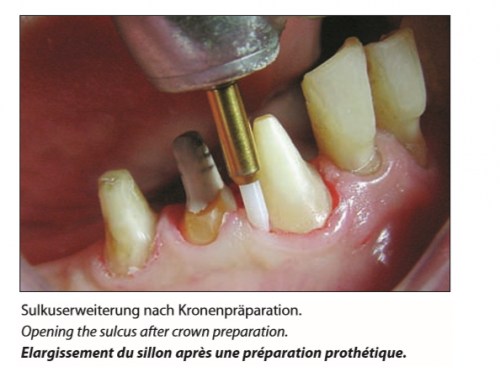 Trimmer Tissue (3)