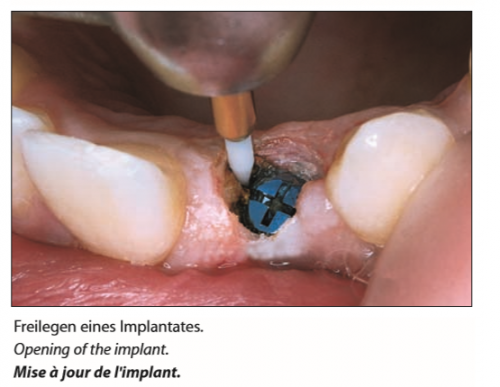 Trimmer Tissue (4)