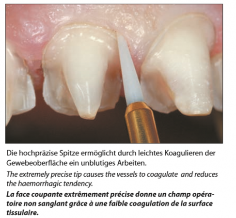 Trimmer Tissue