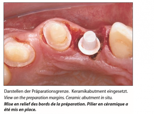 Trimmer Tissue (7)